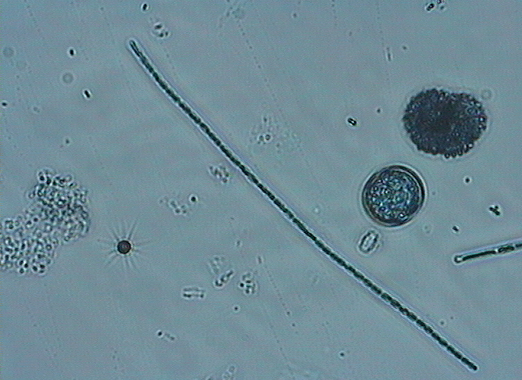 Dictyocha speculum